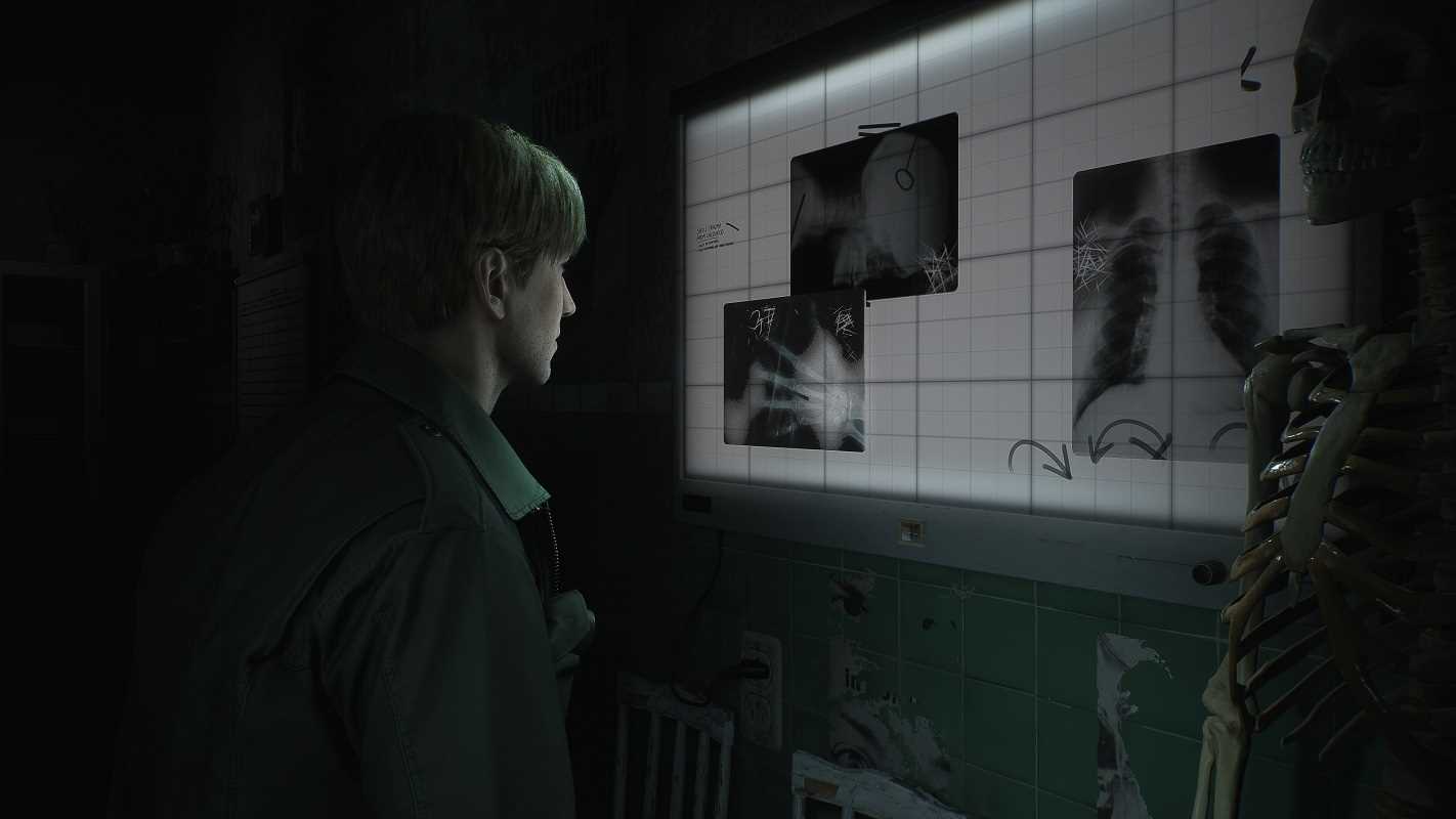 Silent Hill 2 Remake Review – A Haunting Revival